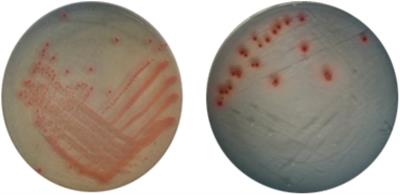 Induction of <mark class="highlighted">Viable but Nonculturable</mark> Escherichia coli O157:H7 by Low Temperature and Its Resuscitation